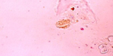 Microsporidia2