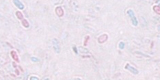 Microsporidia7