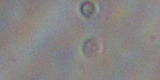 Giardia intestinalis2