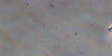 Giardia intestinalis4