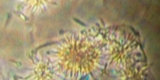 Leishmania infantum1
