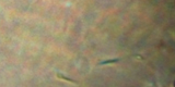 Leishmania infantum2