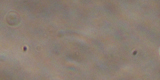 Trichomonas vaginalis1