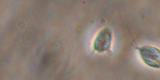 Trichomonas vaginalis2