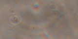 Trichomonas vaginalis3