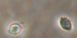 Trichomonas vaginalis4