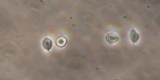 Trichomonas vaginalis5